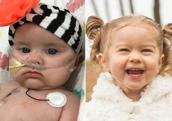 Berkat Katup Jantung Terkecil di Dunia, Balita Ini Akhirnya Mampu Bertahan Hidup Lebih Lama