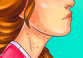 Tidak Melulu Gigi Berlubang, ini 5 Tanda Lain Anda Telah Mengonsumsi Gula Secara 'Brutal'