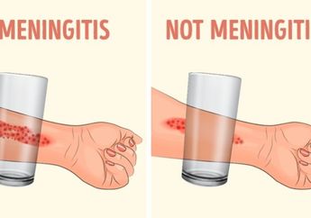 Buktikan Gejala Meningitis dengan Gelas Kaca, Gimana Caranya?