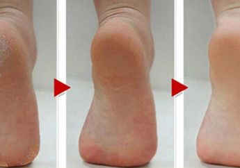 Yuk Rawat Kaki Pecah-pecah dengan Cara Alami, Cuma Pakai 3 Bahan loh