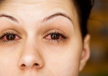 Diduga Iritasi, Wanita Ini Justru Temukan Cacing di Matanya, kok Bisa? Berikut Kisah Selengkapnya