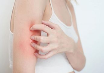 Bermasalah dengan Kulit yang Berjamur? Jangan Digaruk, Atasi Pakai Bahan Rumahan Ini