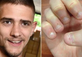 Hobi Menggigit Kuku, Seorang Pria  Hampir Kehilangan Nyawanya