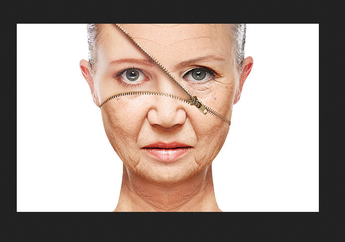 Mengenal Smile Lift by Fotona4D, Perawatan Anti Penuaan dengan Teknologi Canggih Tanpa Bedah