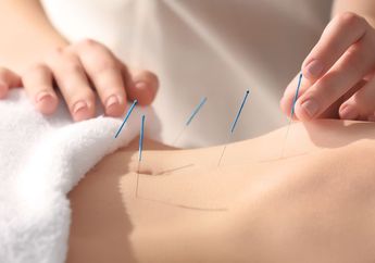 Yuk Simak Cara Kerja Pengobatan Akupuntur untuk Atasi Nyeri Saat Haid!