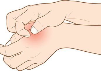 Ketahui 4 Fakta Mengenai Herpes, Salah Satunya Mirip ISK? Kepoin yuk!