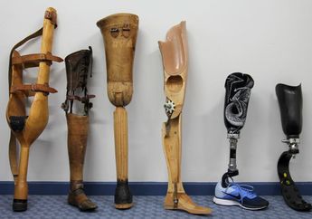 Pengusaha Ini Tawarkan Kaki Palsu untuk Korban Ledakan Bom di Surabaya Secara Gratis