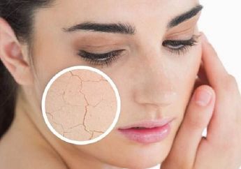5 Kiat Atasi Kulit Kering Saat Berpuasa
