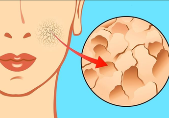 Hati-Hati, Kulit Kering Bisa Menandakan Suatu Penyakit, Jangan Anggap Sepele ya!