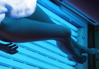 4 Cara Ampuh Obati Psoriasis, Salah Satunya Mirip Taning Kulit, Sudah Kamu Coba Semua Belum?