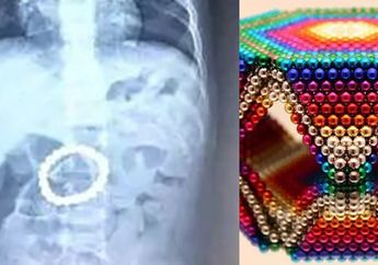 Alami Demam dan Muntah, Ternyata ada Segenggam Manik-manik Magnetik di Tubuh Seorang Balita