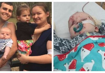 Anak Derita Cacar Air, Cerita Kayley Punya Pesan Khusus Buat Para Orang Tua