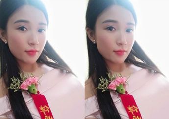 Menjadi 'Bridesmaid' 2 Hari Berturut-turut, Seorang Wanita Harus Rela Kakinya Diamputasi