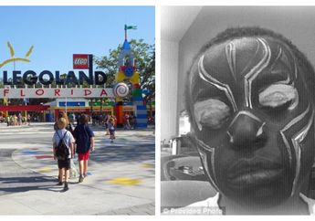 Lukis Wajah Biar Mirip Superhero, Seminggu Kemudian Lihat Apa Terjadi Pada Wajah Bocah Laki-laki Ini