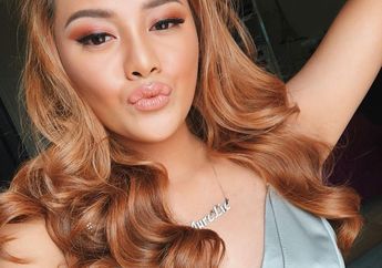 Ganti Warna Rambut, Netizen Perhatikan Bintik Putih di Rambut Aurel Hermansyah, Ketombe?