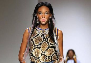 Supermodel Winnie Harlow Tampil Seksi dengan Slit Dress di Acara CFDA Awards 2018, Penasaran?