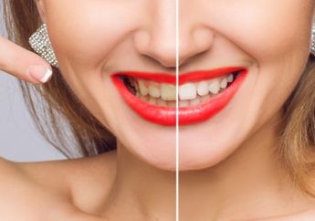 Tak Hanya Kulit Pisang, 5 Bahan Alami Ini Juga Ampuh Putihkan Gigi Kuning