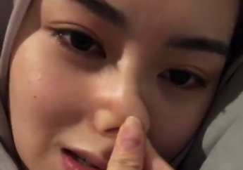 Dirumorkan Operasi Plastik, Selebgram Korea Selatan Pamer Wajah Aslinya