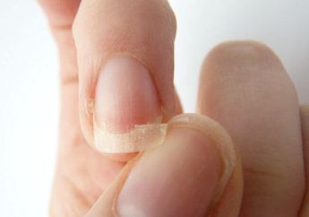 Inilah 5 Penyebab Kuku Rapuh, Salah Satunya Kebiasaan Cewek-cewek nih, Kepoin yuk!