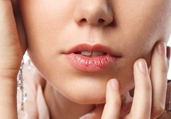 Mengatasi Bibir Pecah-pecah dengan Cara Mudah dari Ahli Dermatologi Berikut Ini, Ikutin Yuk!