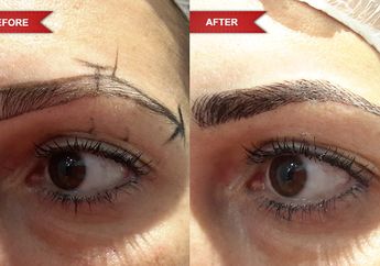 4 Hal yang Harus Kamu Ketahui Sebelum Memilih Tindakan Sulam Alis