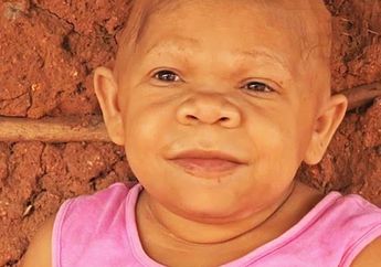 Berusia 37 Tahun, Perempuan Ini Punya Tubuh Layaknya Seorang Bayi