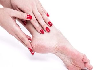 Atasi Kapalan pada Kaki dengan Bawang Putih dan Cuka, Mudah loh Caranya