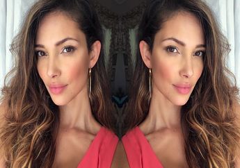 Model Victoria's Secret Gugat Hotel Karena Alami Luka di Sekujur Tubuhnya 