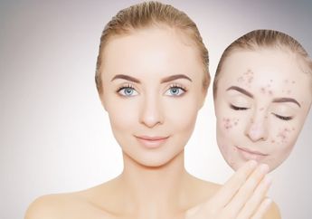 Banyak yang Nggak Tahu, Buah Nanas Ternyata Bisa Hilangkan Flek Hitam Pada Wajah!