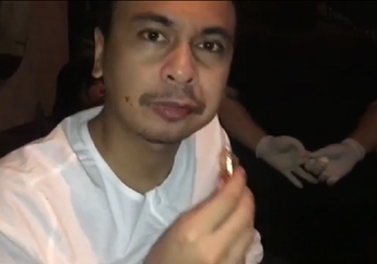 Buktikan Dirinya Seorang Lelaki Sejati, Raditya Dika Makan Beling