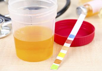 Kenali Tanda 4 Penyakit Kronis Lewat Urine yang Sering Berbusa