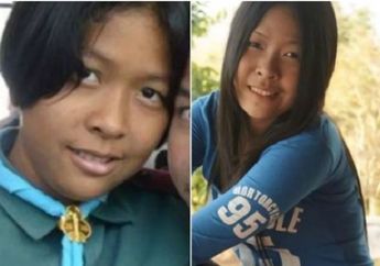 Ditolak Gebetan Karena Jelek, Remaja Putri Ini Kini Jadi Primadona Para Pria