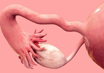 Survei Ungkap Gejala Kanker Ovarium yang Jarang Diketahui Oleh Wanita