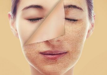 Meracik Ramuan Alami yang Ampuh Usir Kulit Kering dan Bersisik, Mudah kok