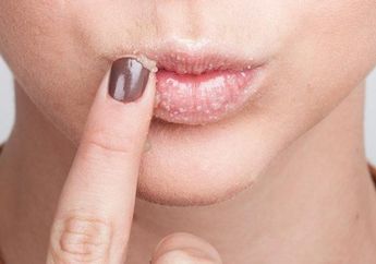 Cara Menghilangkan Warna Hitam&nbsp;pada Bibir dengan Bahan-bahan Alami yang Wajib Kamu Coba!