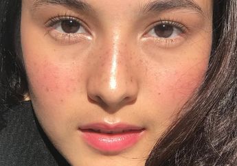 3 Cara Mudah Bikin Makeup Freckles, Coba yuk Biar Nggak Ketinggalan Tren!