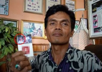 Kondisi Balita yang Digendong Dadang Mulya Dalam Foto di Bungkus Rokok