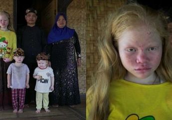 Melihat Kampung Albino di Tanah Sunda Sejak Ratusan Tahun Lalu
