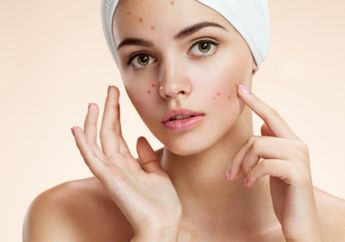 4 Rekomendasi Skincare 10 Ribuan untuk Kulit Berjerawat dan Berkomedo!