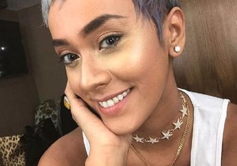 Tak Rela Dikira Hasil Permak, Kimmy Jayanti Bagikan Rahasia Gigi Putihnya