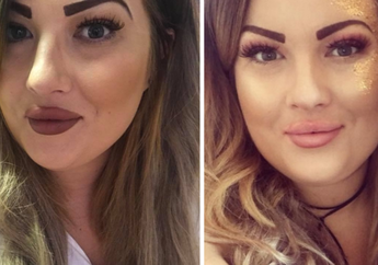 Wanita ini Mencukur 'Kumisnya', Namun Wajahnya Malah Seperti ini