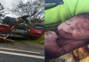 Terlahir Dengan Cara Mengerikan, Bayi ini Tersenyum Saat Diselamatkan