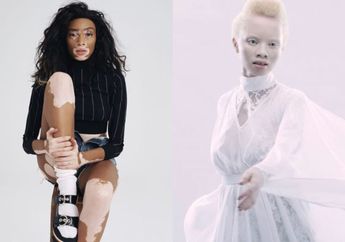 Identik dengan Penampilan Menarik, 4 Model Ini Justru Punya Tubuh Unik