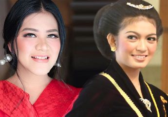 Perbedaan dan Persamaan Persalinan Anak dan Menantu Presiden Joko Widodo