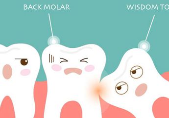 Kenali Gejala Tumbuhnya Gigi Geraham, Salah Satunya Pusing? Berikut Penjelasannya