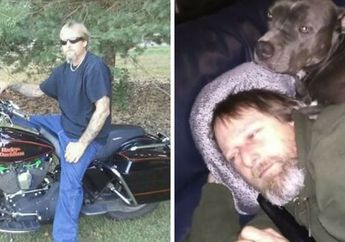 Pecinta Hewan Diamputasi Kaki dan Tangannya Akibat Jilatan Anjing