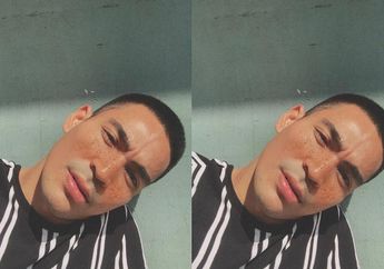 Tak Mau Kalah Hits dari Artis Wanita, 3 Artis Pria Ini Juga Pamer Foto dengan Wajah Freckles