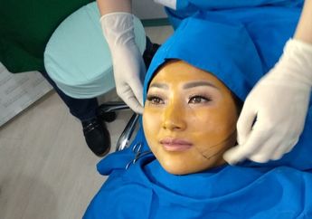 Pipi Chubby, Sarwendah Pilih Perawatan Tanam Benang Daripada Operasi