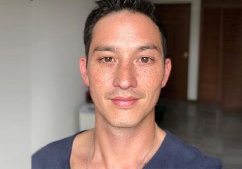 Tak Kalah Kekinian, 3 Artis Pria Ini Ikut Pamer Foto Close Up dengan Freckles