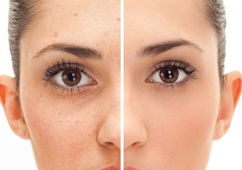 Hilangkan Jerawat Bruntusan Hanya dengan Oatmeal, Coba yuk Biar Wajahmu Kinclong!